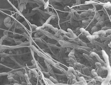 Microscopic image of bacteria assoiates of southern pine beetle