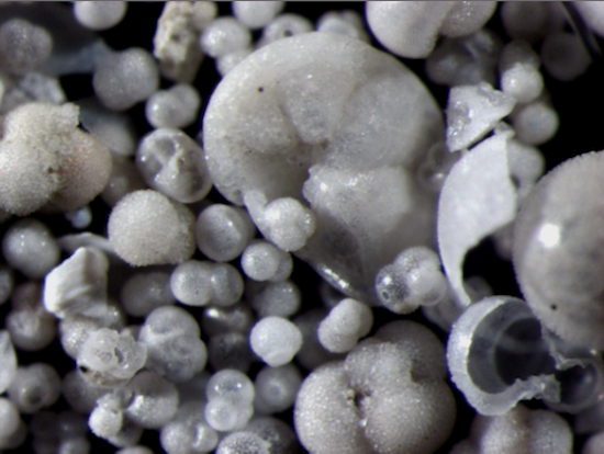 Photo: foraminifera