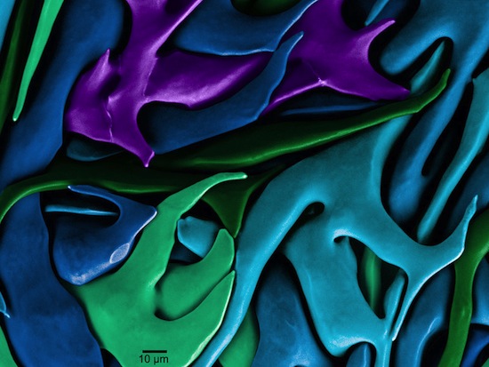 Photo: sea urchin tooth