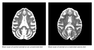 Brain scans of monkeys