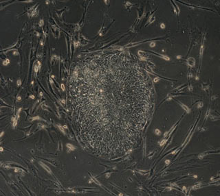 Photo of stem cells