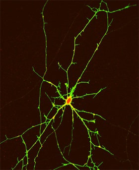 Photo: GABA neuron