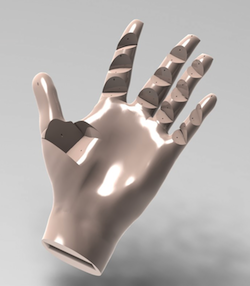 Photo: prosthetic hand