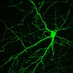 Image: neural stem cell