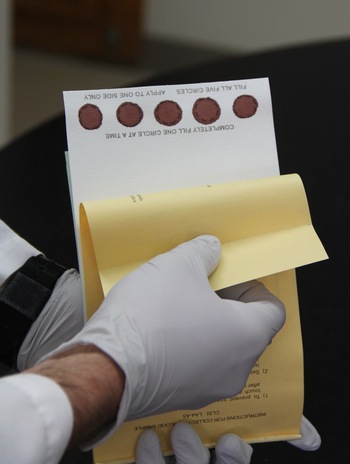 Photo: hands holding card with dried blood samples